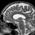 A human brain scan.